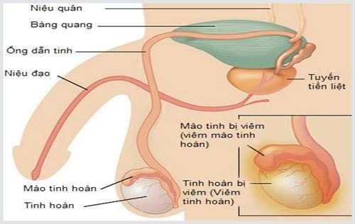 dau-hieu-nhan-biet-benh-nam-khoa-9